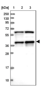 Lane 1: Marker [kDa] 250, 130, 95, 72, 55, 36, 28, 17, 10_br/_Lane 2: Human cell line RT-4_br/_Lane 3: Human cell line U-251MG sp