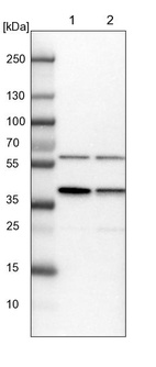 Anti-PRPF18 Antibody