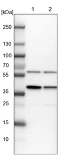 Lane 1: NIH-3T3 cell lysate (Mouse embryonic fibroblast cells)_br/_Lane 2: NBT-II cell lysate (Rat Wistar bladder tumour cells)
