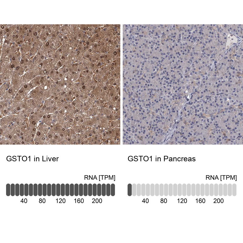 Anti-GSTO1 Antibody