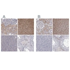 Immunohistochemical staining of human kidney, liver, pancreas and testis using Anti-GSTO1 antibody HPA037603 (A) shows similar protein distribution across tissues to independent antibody HPA037604 (B).