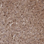 Immunohistochemical staining of human liver shows strong cytoplasmic and nuclear positivity in hepatocytes.