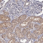 Immunohistochemical staining of human kidney shows moderate cytoplasmic positivity in cells in tubules.