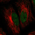 Immunofluorescence staining in HeLa cell line with Anti-ATRX monoclonal antibody, showing clear nuclear (without nucleoli) staining in green. Microtubule- and nuclear probes are visualized in red and blue respectively (where available).
