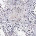 Immunohistochemical staining of human testis shows weak cytoplasmic positivity in Leydig cells as expected.