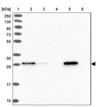 Lane 1: Marker [kDa] 250, 130, 95, 72, 55, 36, 28, 17, 10_br/_Lane 2: Human cell line RT-4_br/_Lane 3: Human cell line U-251MG sp_br/_Lane 4: Human plasma (IgG/HSA depleted)_br/_Lane 5: Human liver tissue_br/_Lane 6: Human tonsil tissue