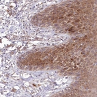 Anti-BPIFC Antibody