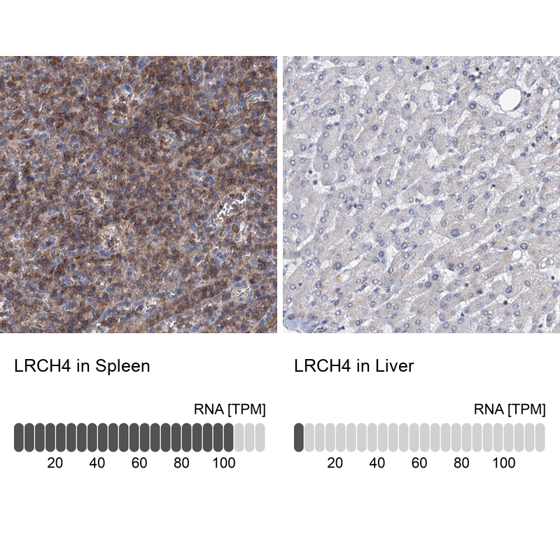 Anti-LRCH4 Antibody