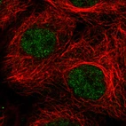 Immunofluorescence staining in A431 cell line with Anti-ATRX monoclonal antibody, showing clear nuclear (without nucleoli) staining in green. Microtubule- and nuclear probes are visualized in red and blue respectively (where available).