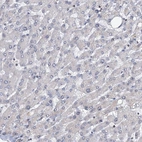 Immunohistochemical staining of human liver shows low expression as expected.