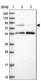 Lane 1: Marker [kDa] 250, 130, 95, 72, 55, 36, 28, 17, 10_br/_Lane 2: Human cell line RT-4_br/_Lane 3: Human cell line U-251MG sp