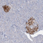 Anti-RFX6 Antibody