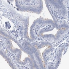 Immunohistochemical staining of human fallopian tube shows weak positivity in cilia in glandular cells.