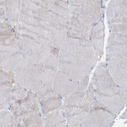 Immunohistochemical staining of human skeletal muscle shows very weak positivity in myocytes as expected.