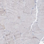 Immunohistochemical staining of human skeletal muscle shows very weak positivity in myocytes as expected.