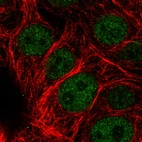 Immunofluorescence staining in MCF7 cell line with Anti-ATRX monoclonal antibody, showing clear nuclear (without nucleoli) staining in green. Microtubule- and nuclear probes are visualized in red and blue respectively (where available).