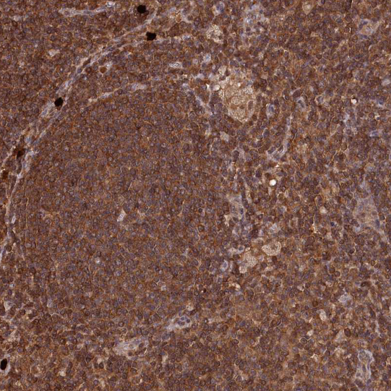 Anti-LSG1 Antibody