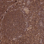 Anti-LSG1 Antibody