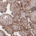 Immunohistochemical staining of human placenta shows strong cytoplasmic and nuclear positivity in trophoblastic cells.