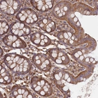 Immunohistochemical staining of human colon shows moderate cytoplasmic positivity in glandular cells.