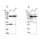 Western blot analysis using Anti-LSG1 antibody HPA037704 (A) shows similar pattern to independent antibody HPA037705 (B).