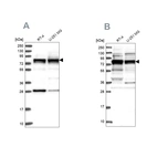 Western blot analysis using Anti-LSG1 antibody HPA037704 (A) shows similar pattern to independent antibody HPA037705 (B).