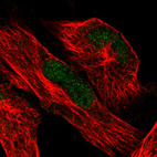 Immunofluorescence staining in U251 cell line with Anti-ATRX monoclonal antibody, showing clear nuclear (without nucleoli) staining in green. Microtubule- and nuclear probes are visualized in red and blue respectively (where available).