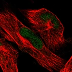 Immunofluorescence staining in U251 cell line with Anti-ATRX monoclonal antibody, showing clear nuclear (without nucleoli) staining in green. Microtubule- and nuclear probes are visualized in red and blue respectively (where available).