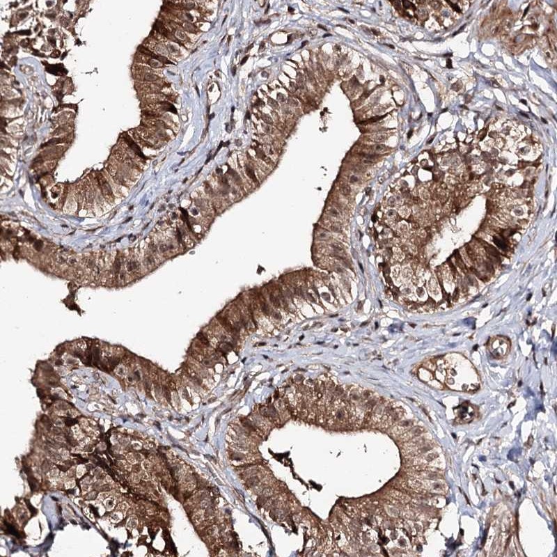 Anti-FAM53B Antibody
