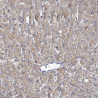 Anti-MBLAC2 Antibody