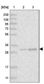 Anti-MBLAC2 Antibody
