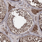 Immunohistochemical staining of human Testis shows strong cytoplasmic positivity in cells in seminiferous ducts and Leydig cells.