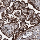 Immunohistochemical staining of human Placenta shows strong cytoplasmic positivity in trophoblastic cells.