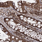 Immunohistochemical staining of human Rectum shows strong cytoplasmic positivity in glandular cells.