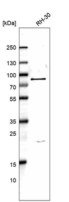 Western blot analysis in human cell line RH-30.