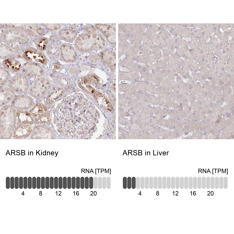 Anti-ARSB Antibody