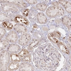Immunohistochemical staining of human kidney shows high expression.