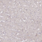 Immunohistochemical staining of human liver shows low expression as expected.