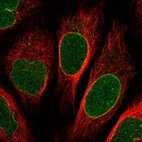 Immunofluorescent staining of human cell line U-2 OS shows localization to nuclear membrane.