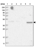 Lane 1: Marker [kDa] 230, 130, 95, 72, 56, 36, 28, 17, 11_br/_Lane 2: Human cell line RT-4_br/_Lane 3: Human cell line U-251MG sp_br/_Lane 4: Human plasma (IgG/HSA depleted)_br/_Lane 5: Human liver tissue_br/_Lane 6: Human tonsil tissue