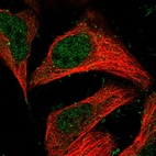 Immunofluorescent staining of human cell line U-2 OS shows localization to nucleoplasm & plasma membrane.
