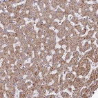 Anti-PSTK Antibody