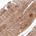 Immunohistochemical staining of human skeletal muscle shows moderate cytoplasmic positivity in myocytes.