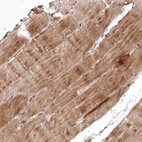 Immunohistochemical staining of human skeletal muscle shows moderate cytoplasmic positivity in myocytes.