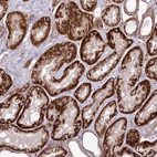 Immunohistochemical staining of human kidney shows strong granular cytoplasmic positivity in cells in tubules.