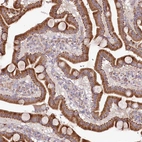 Immunohistochemical staining of human duodenum shows moderate granular cytoplasmic positivity in glandular cells.