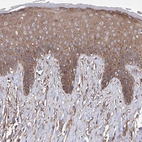 Immunohistochemical staining of human skin shows strong cytoplasmic positivity in squamous epithelial cells.