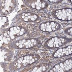 Immunohistochemical staining of human rectum shows strong cytoplasmic positivity in lymphoid cells.