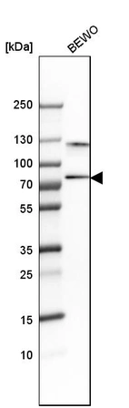 Western blot analysis in human cell line BEWO.
