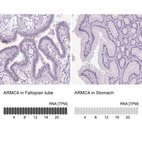 Anti-ARMC4 Antibody